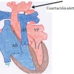 Enfrentamiento circulatorio: Sistemas Circulatorios Mayor vs. Menor