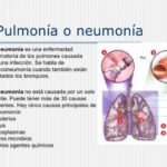 Bronquitis vs Neumonía: Comparativa y 7 Diferencias Clave