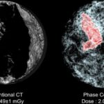 CT Scan vs Ultrasonido: Descubre las 10 Diferencias Clave