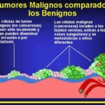 Cuál es la principal diferencia entre un tumor y cáncer